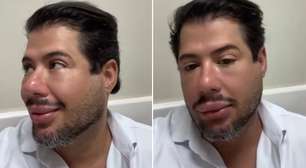 Hugo, da dupla com Tiago, mostra resultado de harmonização