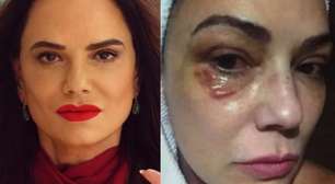 Luiza Brunet quebra o silêncio após condenação do ex por agressões: 'Muito pouco'