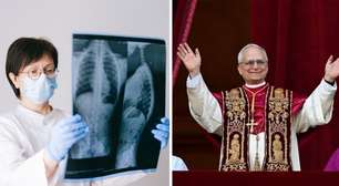 Nódulo pulmonar é sempre câncer? Entenda o caso do papa Leão XIV