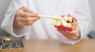 Perda de dentes impacta alimentação e qualidade de vida no Brasil
