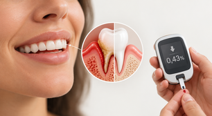 Tratar a gengiva ajuda no controle do diabetes