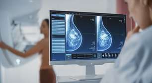 Novos medicamentos, supercomputadores: como é o tratamento de câncer de mama agora?