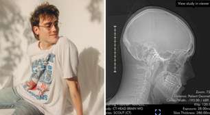 Músico ficará acordado durante cirurgia de 6 horas para retirar tumor do cérebro