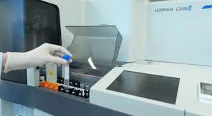 Exame de sangue para Alzheimer chega ao Brasil: veja quem pode fazer e quanto custa