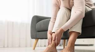 Varizes, lipedema e celulite: como identificar e cuidar das pernas?