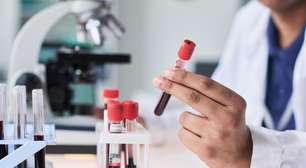 Exame de sangue pode prever demência até 25 anos antes do início dos sintomas em mulheres