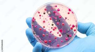 Micotoxinas: pesquisa mundial alerta para riscos na qualidade dos grãos