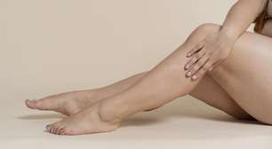 Varizes, lipedema e celulite: saiba como diferenciá-los e cuidar das pernas