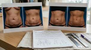 Por que a mesma cirurgia plástica pode ter resultados tão diferentes em cada pessoa