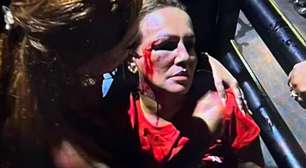 Ataque em ato político: vereadora é atingida na cabeça durante carreata em Minas Gerais