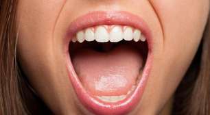 Dicas para Melhorar a Higiene Bucal com Escovas Elétricas e Irrigadores