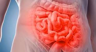 Síndrome do intestino irritável: sintomas, causas e como tratar