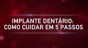 Implante Dentário: Como Cuidarcasadeapostas com r5 Passos