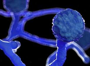 Fungo negro: Brasil teve 29 casos de mucormicose neste ano