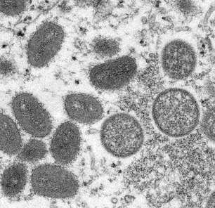 Varíola dos macacos: qual o perfil dos infectados e como isso pode mudar com avanço da doença