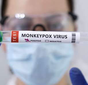 Já é o momento de se preocupar com a varíola dos macacos? Especialistas respondem