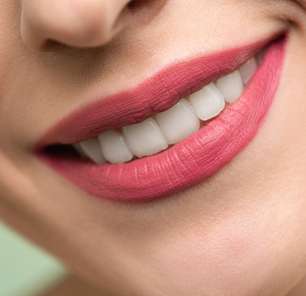 Clareamento dental: mitos e verdades sobre o procedimento