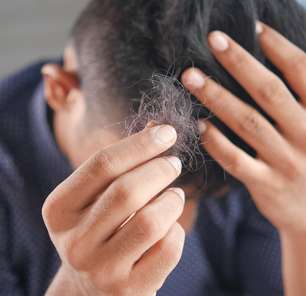 O que fazer com a perda de cabelo depois da covid