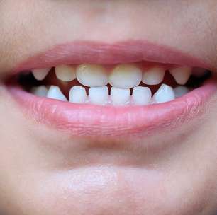Você conhecia essas 4 curiosidades sobre os dentes de leite?