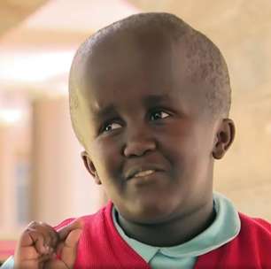 Adolescente com hidrocefalia conta como superou bullying e decidiu virar cantora