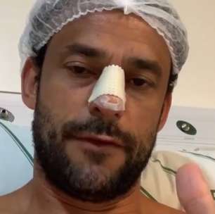 Fred é submetido a cirurgia no nariz após fratura em jogo-treino do Cruzeiro