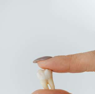 Saiba a função de cada um dos dentes na hora da alimentação
