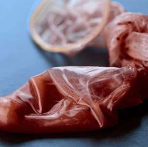 Hematospermia (sangue no esperma): causas e tratamento