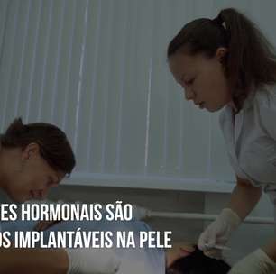 Implante hormonal: veja os mitos e verdades