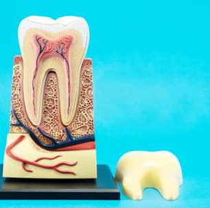 Células-tronco presentes na polpa do dente podem tratar doenças; veja
