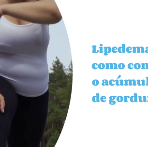 Lipedema: veja como combater o acúmulo de gordura