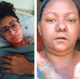 'Nos venderam uma falsa ilusão': o sofrimento de mulheres com o método contraceptivo Essure anos após a proibição