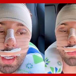 Rico Melquíades explica que fez cirurgia no rosto por 'não aguentar mais ser chamado de feio'