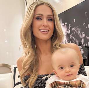 O que pode ter o filho da socialite Paris Hilton? Assimetria craniana é uma possibilidade
