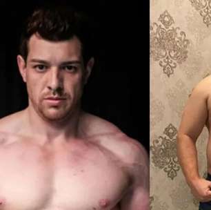 Ex-BBB ganha 40 kg e encontra tumor na nuca após compulsão