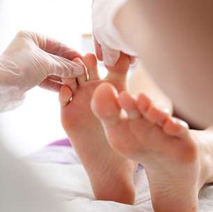 Queimaduras, micoses e brotoejas podem ser mais comuns no verão; saiba como prevenir