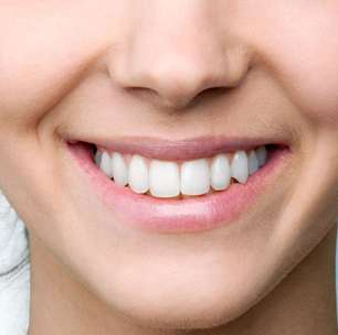 5 dicas para cuidar dos dentes e conquistar um sorriso lindo