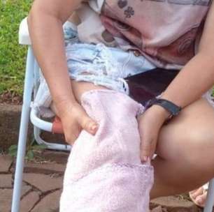 Ataque de cães causa ferimentos graves em idosa em Cruz Alta