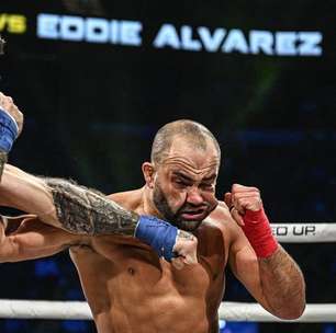 IMAGEM FORTE: Ex-campeão do UFC fica com o rosto 'deformado' após derrota no boxe sem luvas