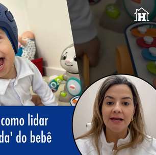 Assimetria craniana: como lidar com a cabeça 'achatada' do bebê