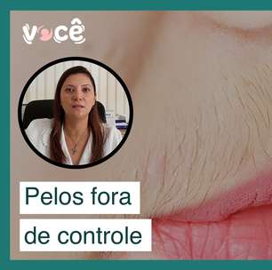 Pelos fora de controle: as mulheres e o hirsutismo