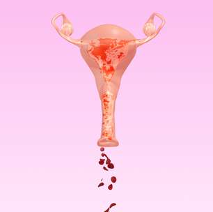Sangramento 2 anos após a menopausa é normal?