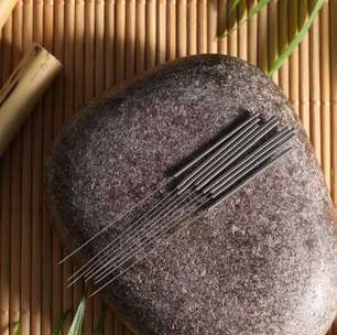Veja como a acupuntura ajuda a combater a cefaleia
