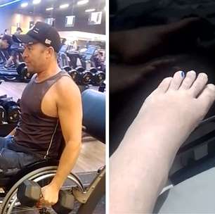 Aluno de academia atingido por aparelho mexe dedo do pé pela primeira vez após acidente