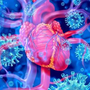 Miocardite: o que é, causas, sintomas e tratamento