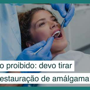 Mercúrio na odontologia: devo tirar a restauração de amálgama?