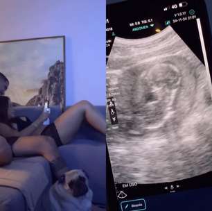 Grávida, Lexa monitora bebê com ultrassom portátil em casa; é seguro?