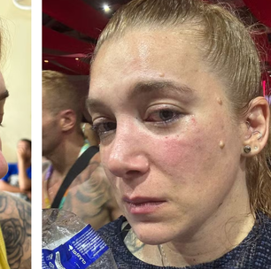 Mulher leva soco no rosto durante show da Anitta no Rio, e diz que motivação foi homofobia