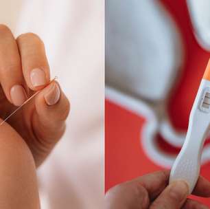 Como a acupuntura pode ajudar no tratamento da infertilidade? Médico responde