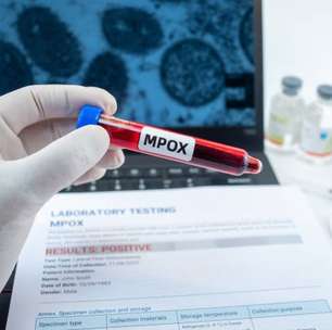 Vacina mpox baseada em mRNA mostra-se promissora em testes