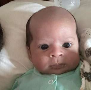 'Bebê calvo' diverte a web e mãe brinca: 'Nasceu parecendo um senhor de 82 anos'